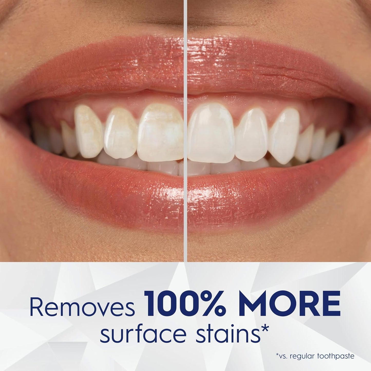 24-hour active stain prevention technology with twice-daily use