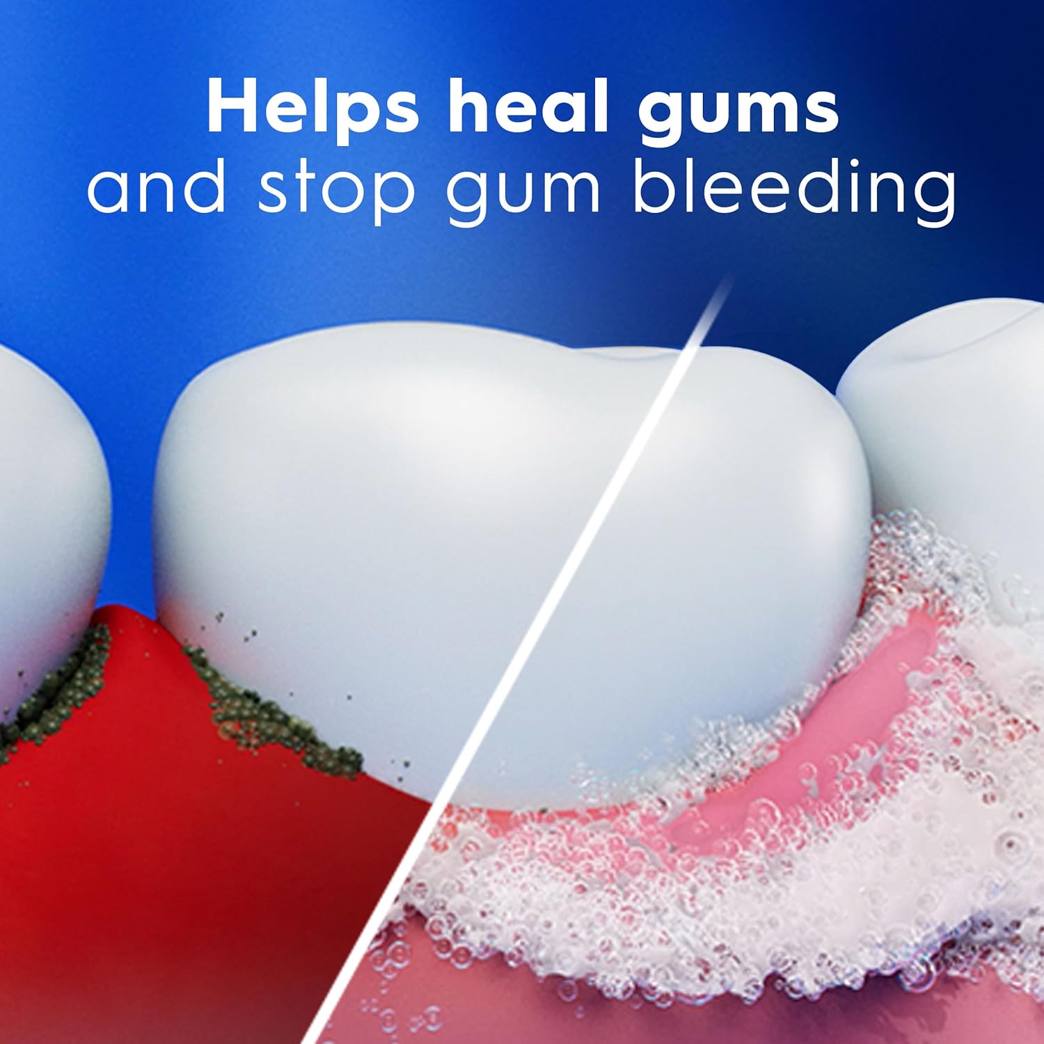 Crest Pro-Health Gum Detoxify Plus Toothpaste – Clinically Proven Gum Protection, No-Risk Formula