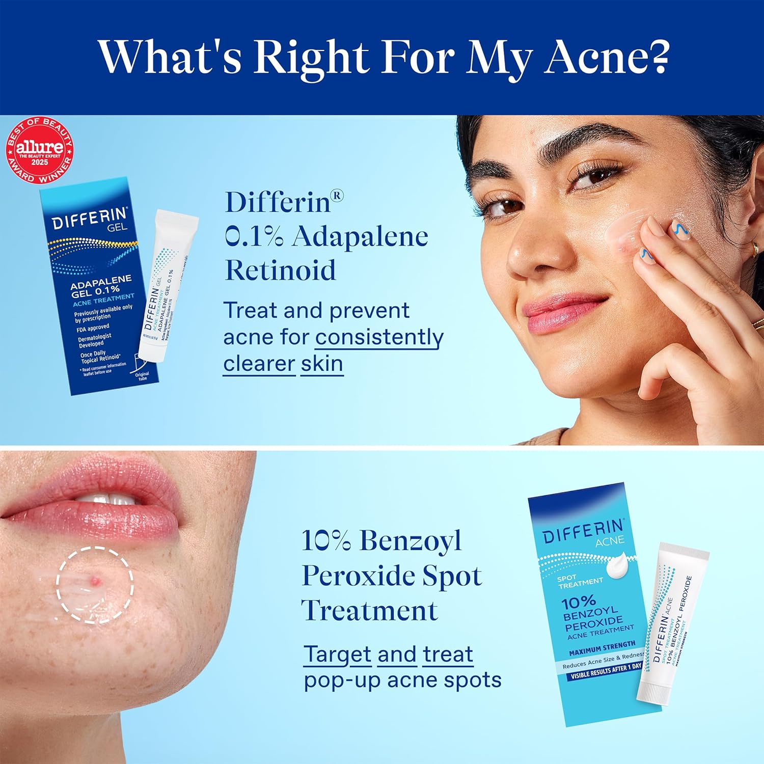 Differin 10% Benzoyl Peroxide Spot Treatment – Family Bathroom Essential for Teen Acne, 1 oz Gel