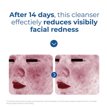 EltaMD Skin Recovery Cleanser – Dermatologist-Formulated Premium Face Wash for Refined Routines