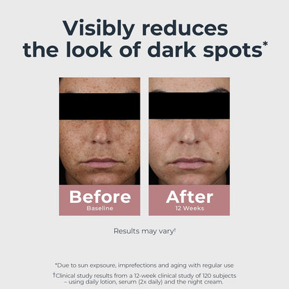 lightweight, non-sticky, non-comedogenic lotion formula