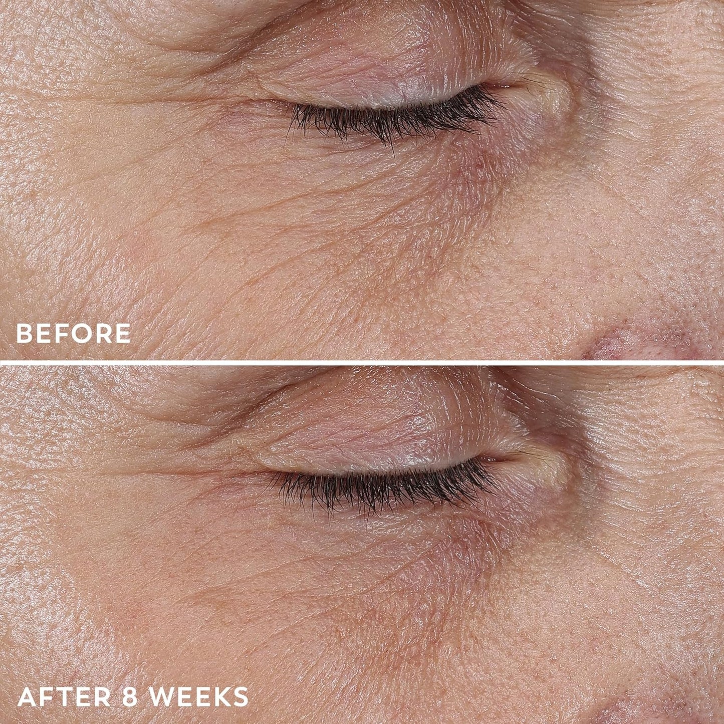 Olay Regenerist Simple Anti-Wrinkle Cream – Minimal Ingredients, Maximum Results